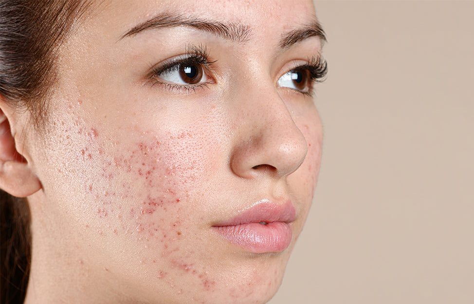 Treatment area before procedure