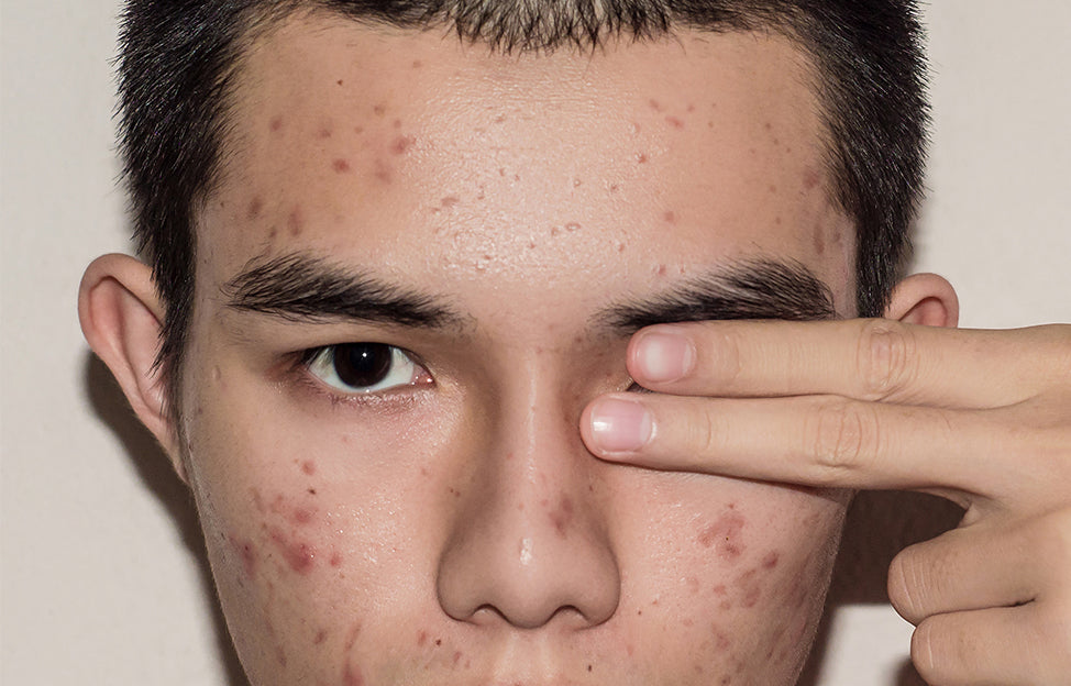 Treatment area before procedure